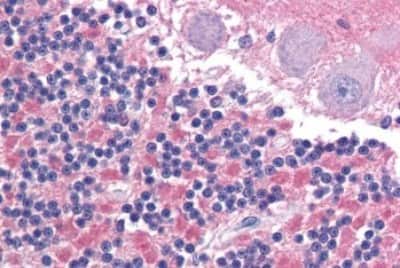 Immunohistochemistry-Paraffin: IGSF4D/SynCAM2/CADM2 Antibody [NBP3-14376]